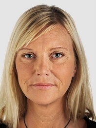 мезотерапия лица фото
